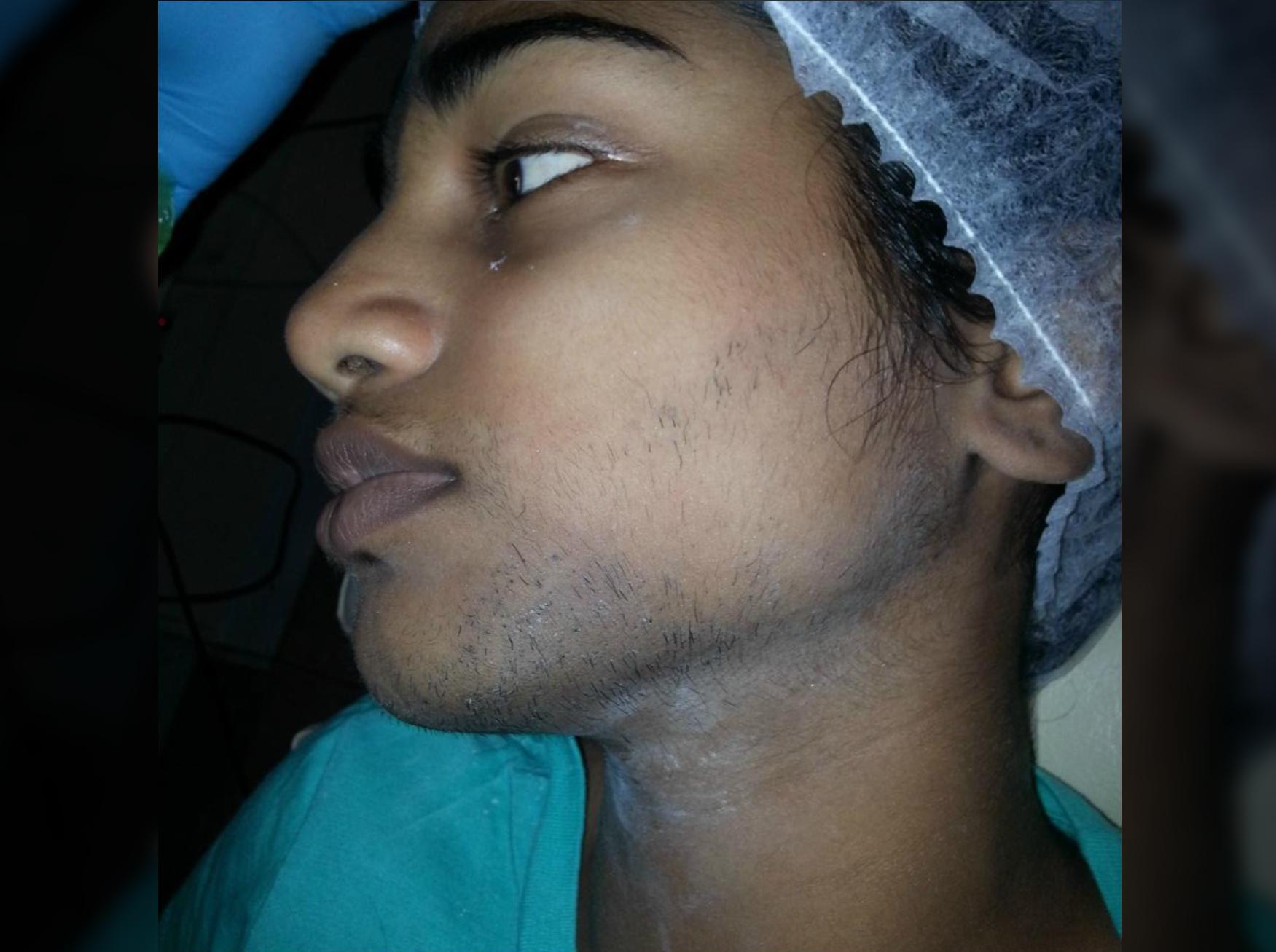 An image of a persons face before sugaring